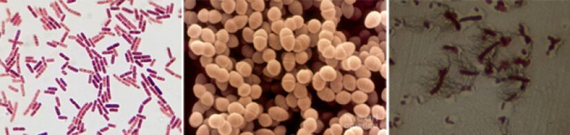 Escherichia coli, fecal and proteus enterococci are the main agents responsible for chronic bacterial prostatitis