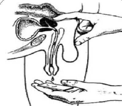 Massage the prostate to obtain secretions