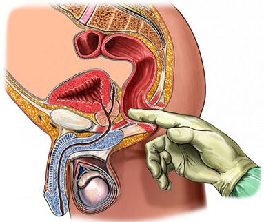 Prostate digital examination
